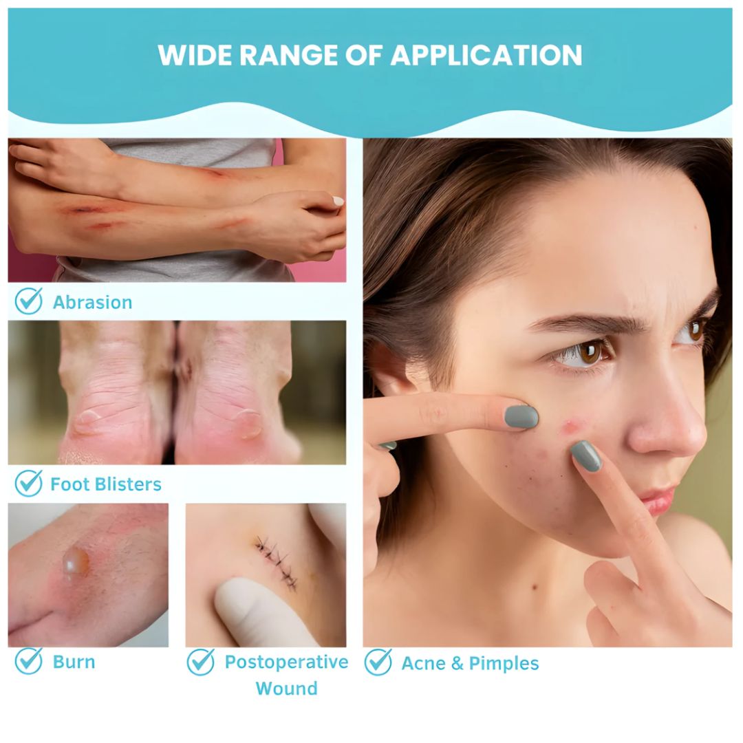 HydraPatch™ Hydrocolloid Roll
