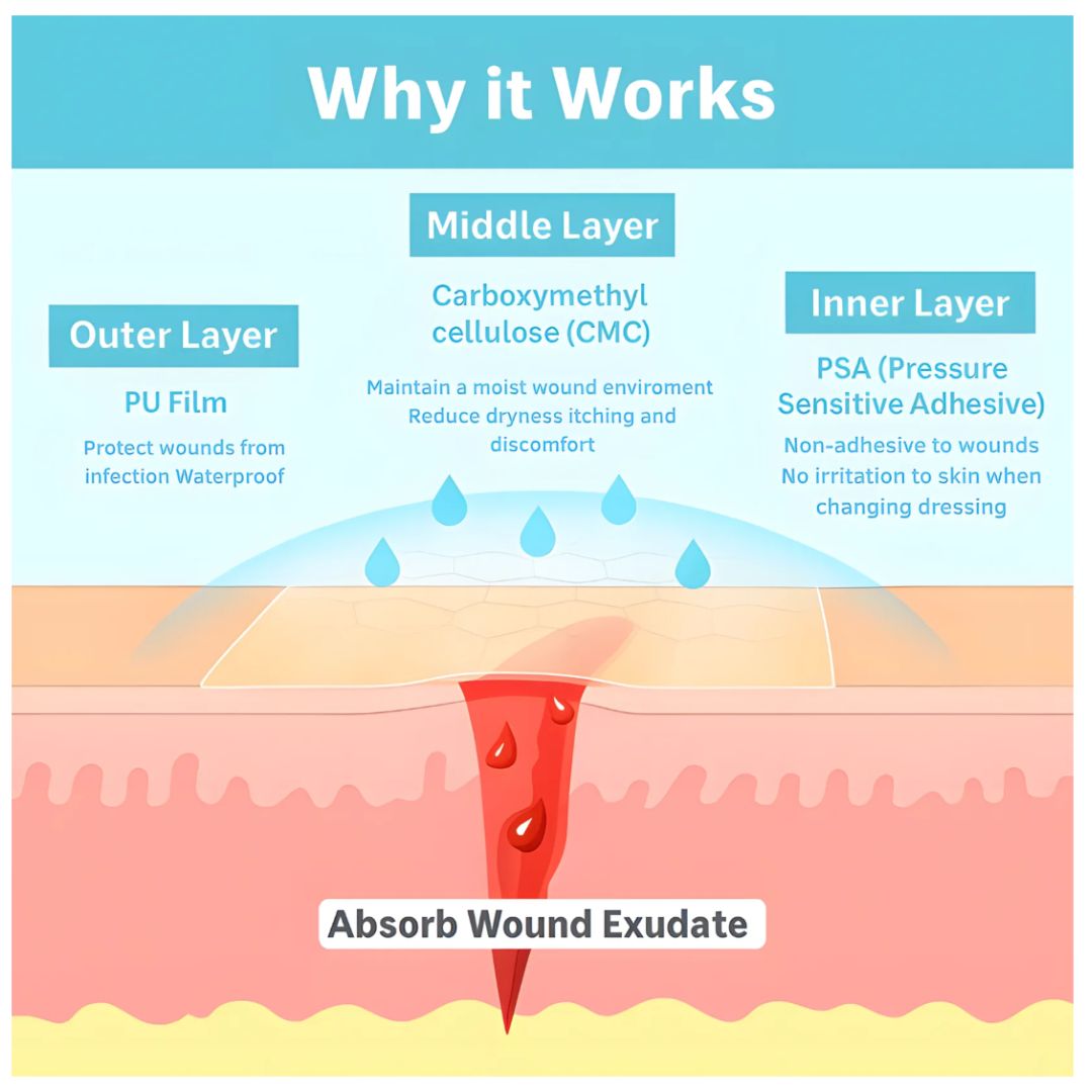 HydraPatch™ Hydrocolloid Roll