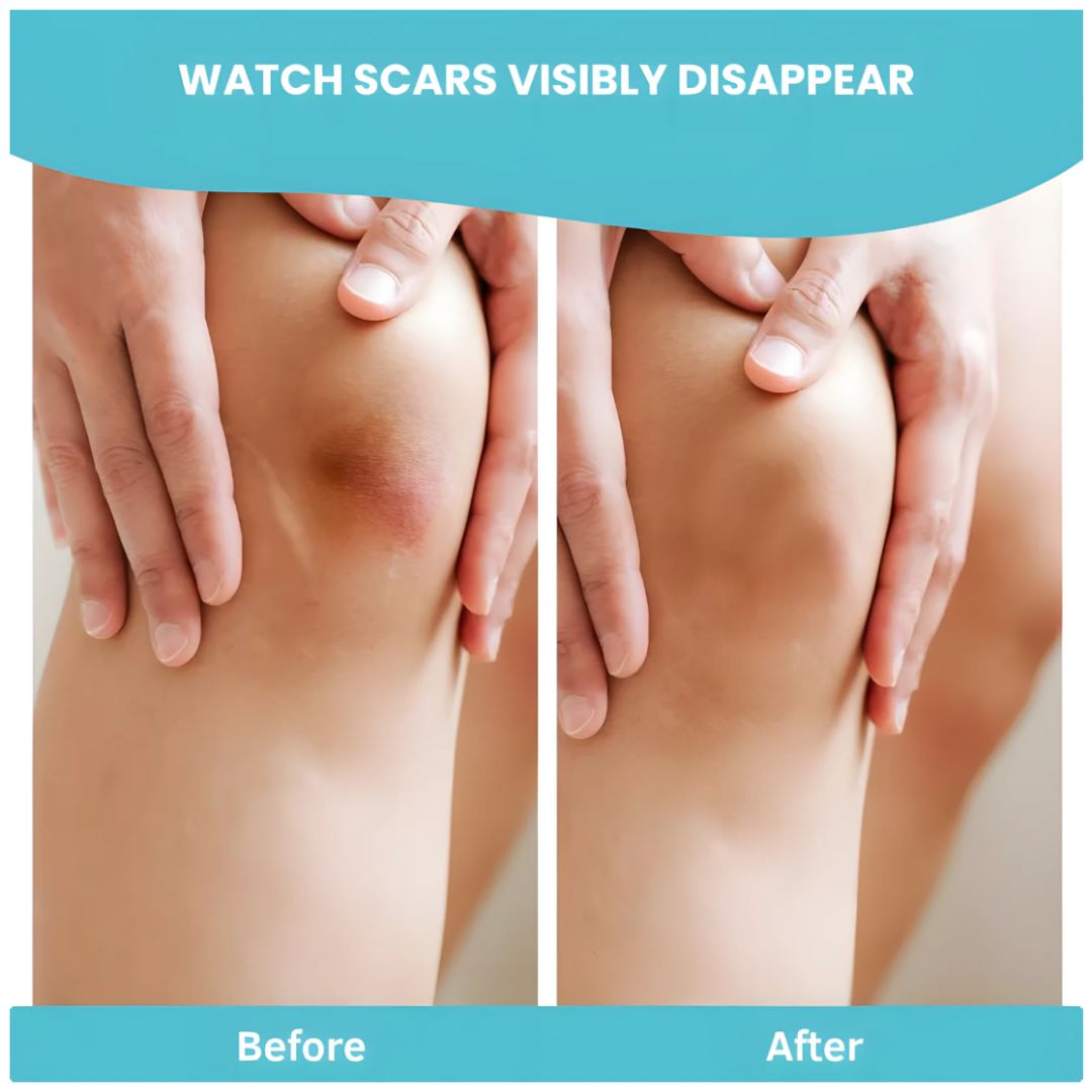 HydraPatch™ Hydrocolloid Roll